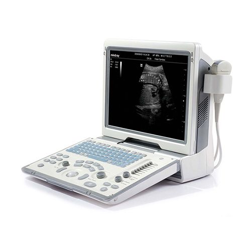 MINDRAY DP 50 portable ultrasound machine for sale 1 1