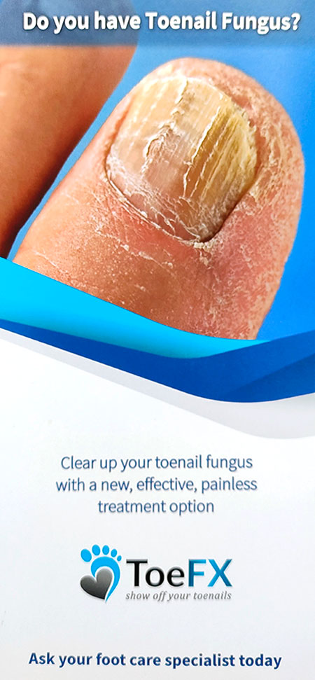 photo of toefx