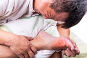 Simple Methods May Possibly Prevent Gout