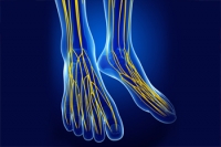 What Is Idiopathic Peripheral Neuropathy