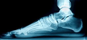 The Purpose of the Arches in the Feet