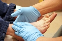 Essential Foot Care Tips for Diabetics