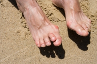 How Can Hammertoes Be Treated?
