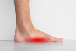 Who Gets Flat Feet?