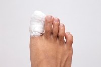 How Is A Broken Toe Treated?