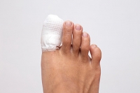 How Is A Broken Toe Treated?